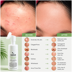 Foaming Gel Cleanser