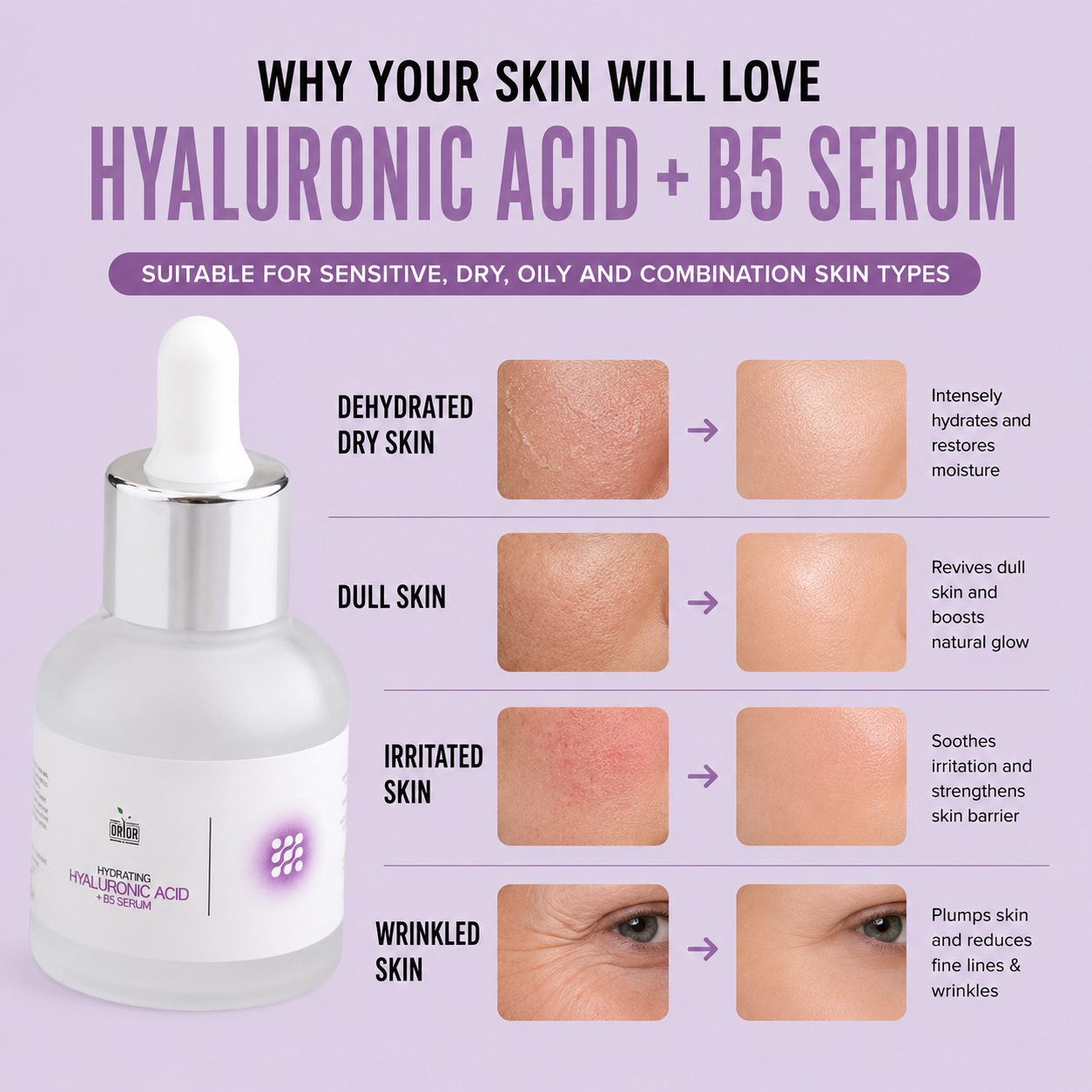 Hydrating Hyaluronic Acid + B5 serum