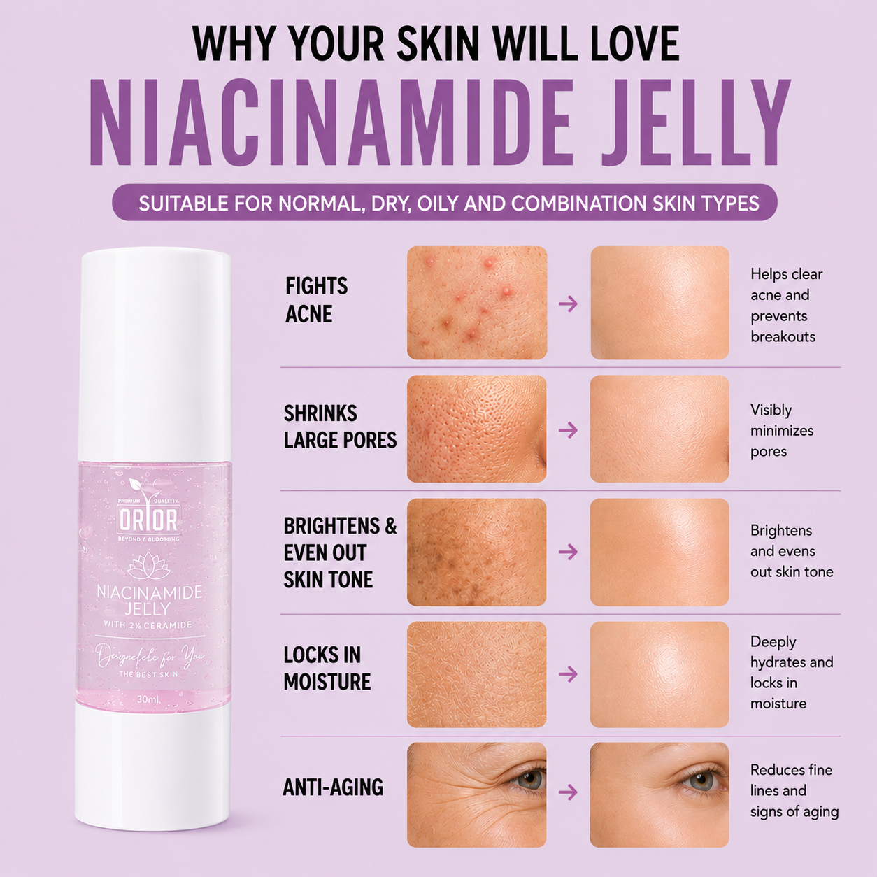 Niacinamide 10% Jelly