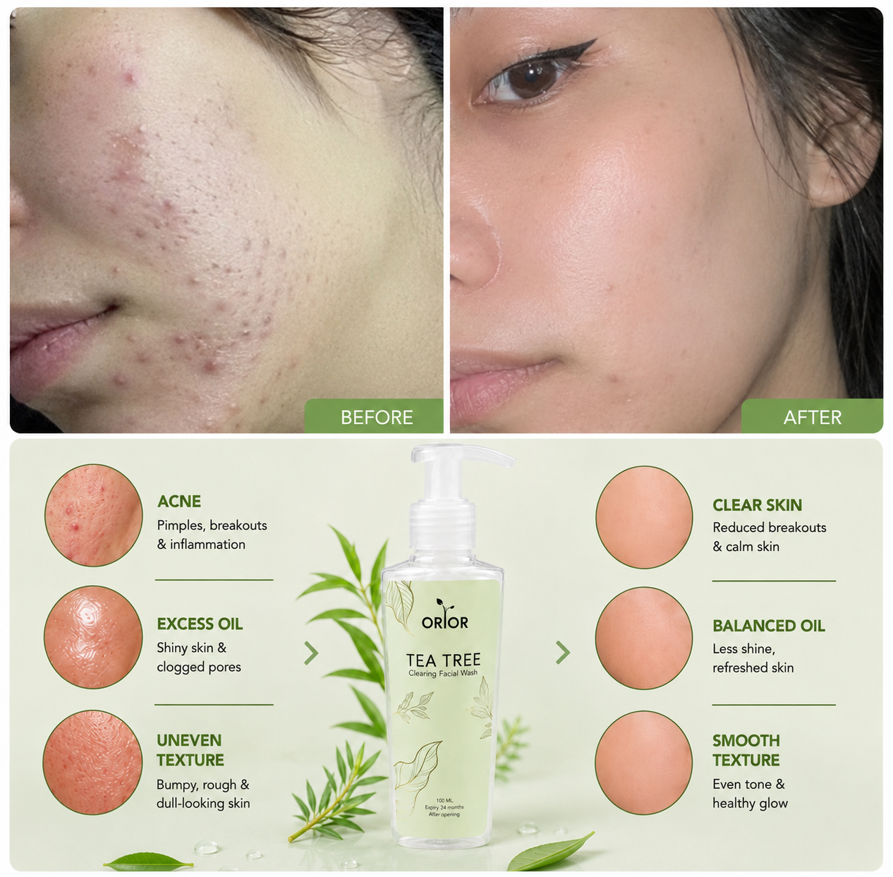 Tea Tree Clearing Facewash
