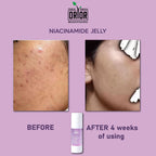 Niacinamide Jelly