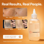 Orior Cosmetics Glycolic Acid 7% Toner bottle with before and after results showing improved skin texture and tone.
