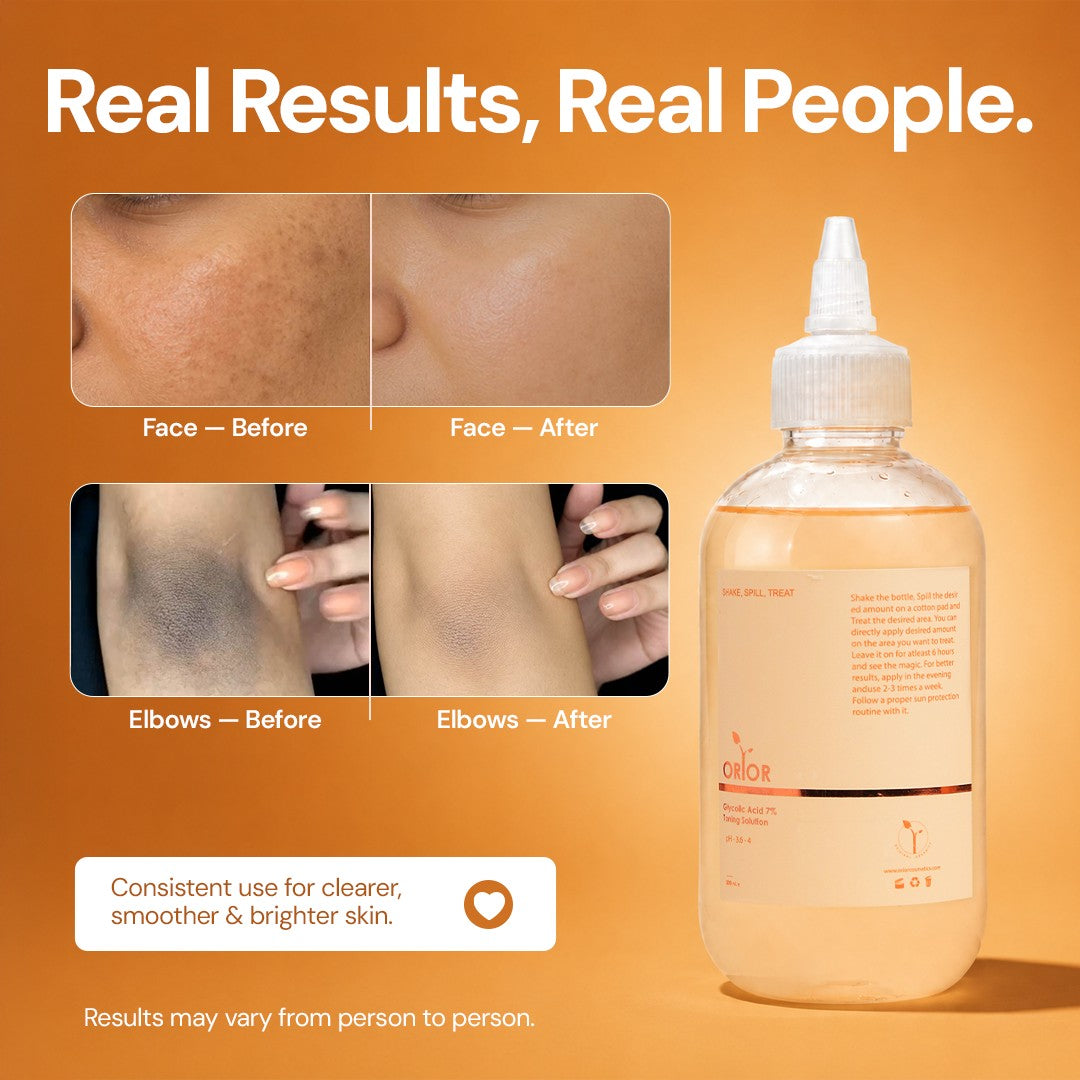 Orior Cosmetics Glycolic Acid 7% Toner bottle with before and after results showing improved skin texture and tone.