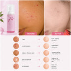 Orior Cosmetics Kojic Acid Foam Cleanser showing before and after results for acne marks, tan, and skin blemishes.