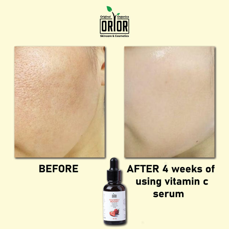 Vitamin C serum