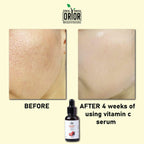 Vitamin C serum