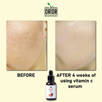 Vitamin C serum